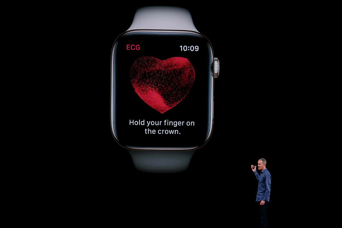 Apple и Johnson & Johnson проверят, смогут ли смарт-часы снизить риск инсульта