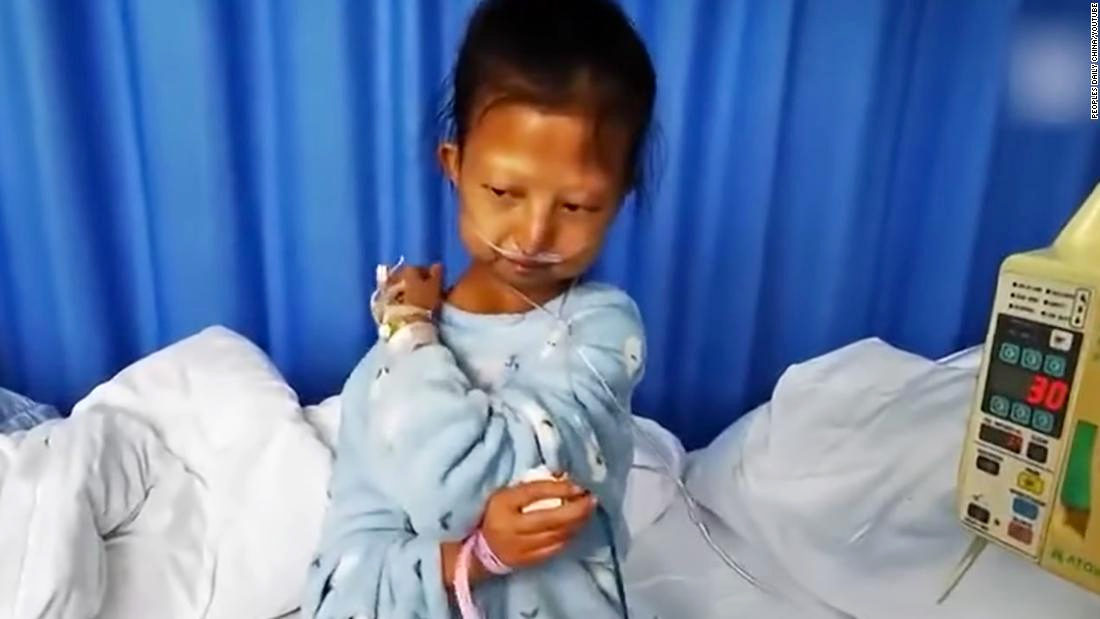 Китайская студентка умерла из-за того, что питалась одним рисом