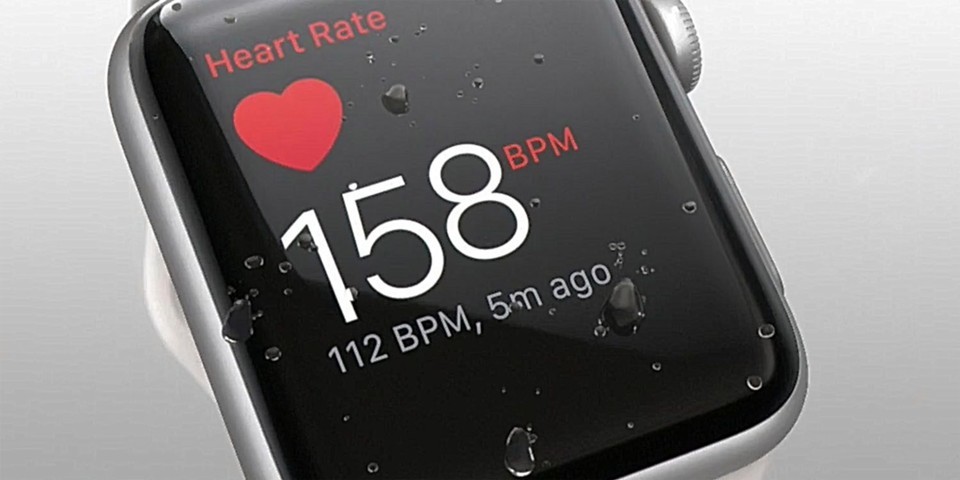 Apple обвиняют в краже технологий для часов Apple Watch