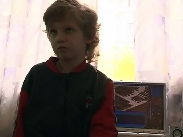 В отношении врачей, из-за которых 10-летний мальчик лишился руки, возбуждено уголовное дело