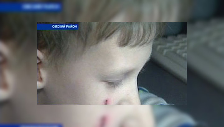 В Омске пытаются собрать деньги на операцию маленькому Севе. Срок идёт на недели