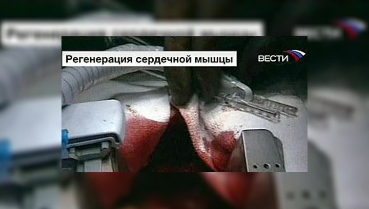 Больному сердцу помогут стволовые клетки