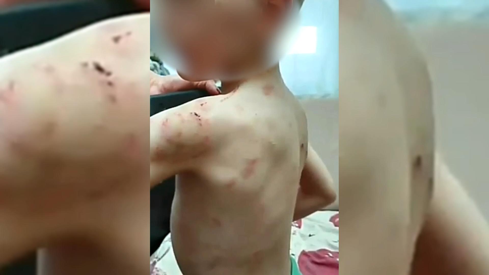 Потоп в квартире помог найти шестилетнего мальчика-маугли в Новороссийске