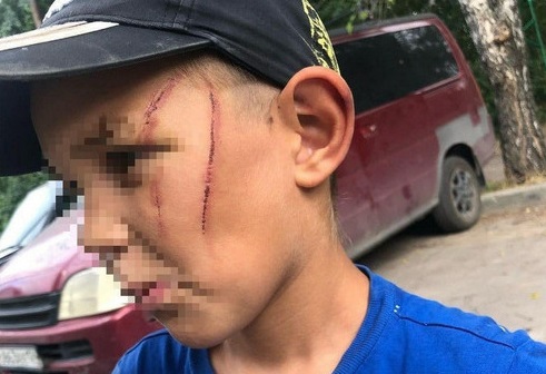 На сибиряка после избиения сына сожительницы кабелем возбудили уголовное дело