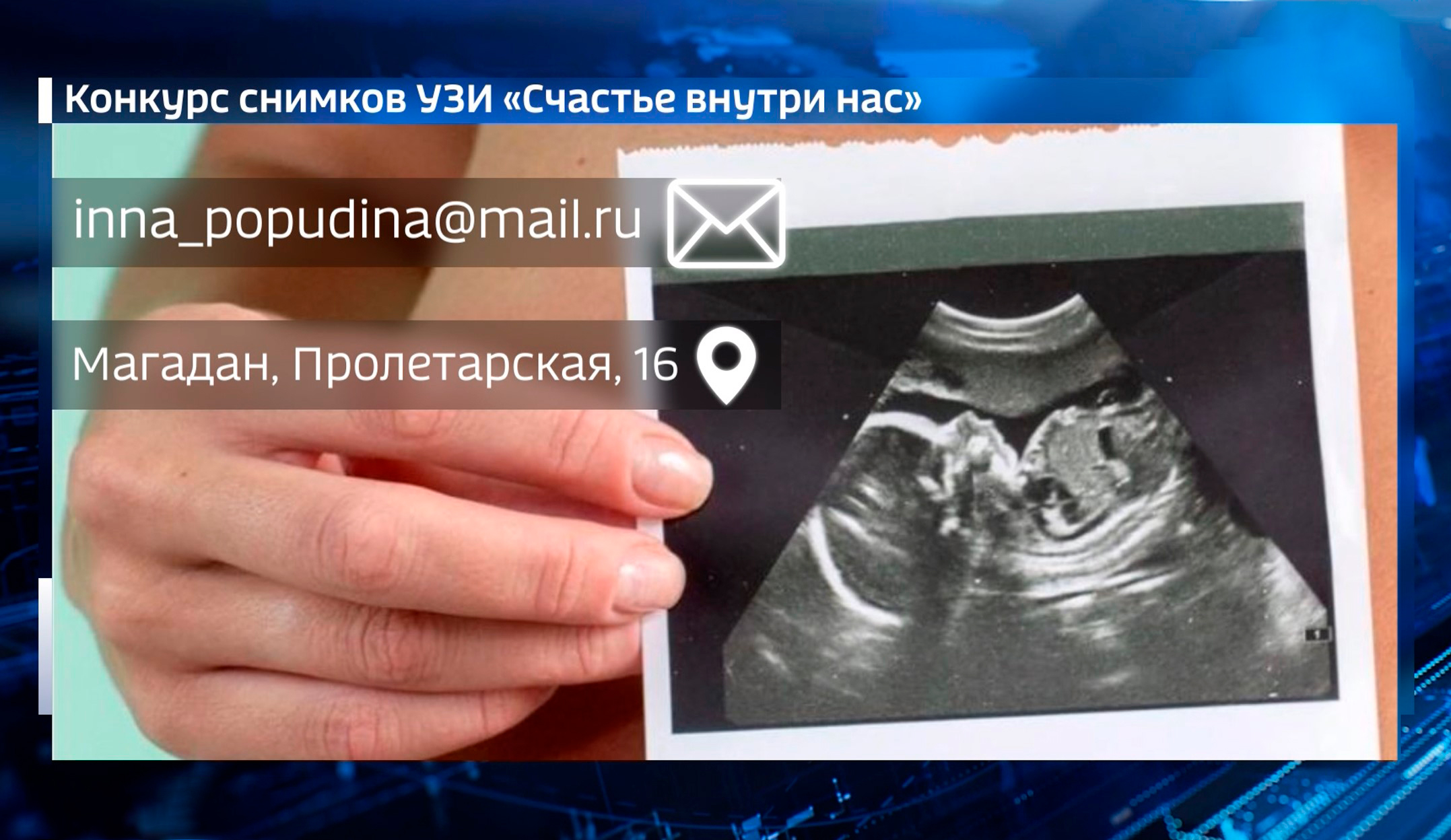 Будущие мамы, хвастайтесь снимками УЗИ – конкурс для беременных