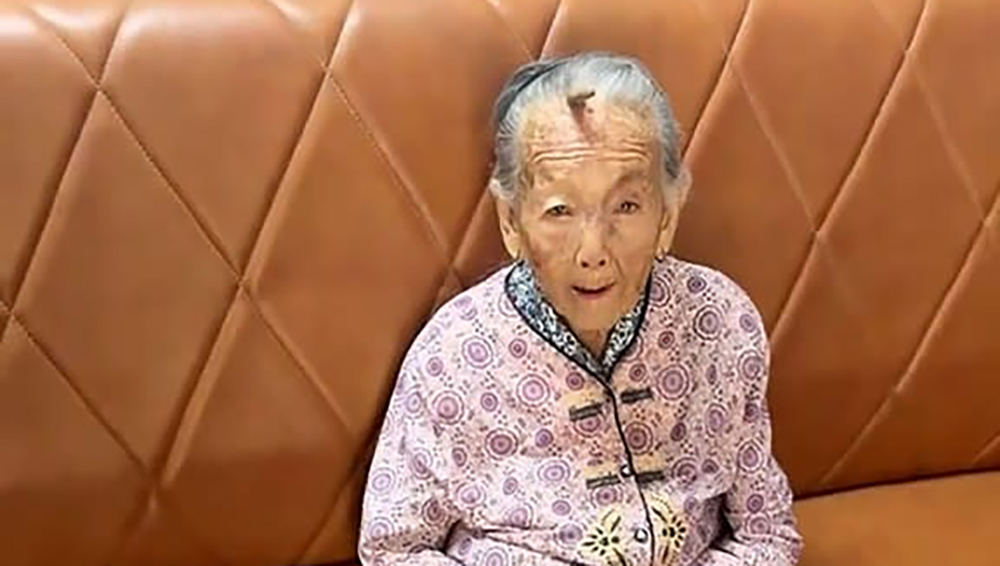 У 107-летней жительницы Китая на лбу вырос "рог долголетия"