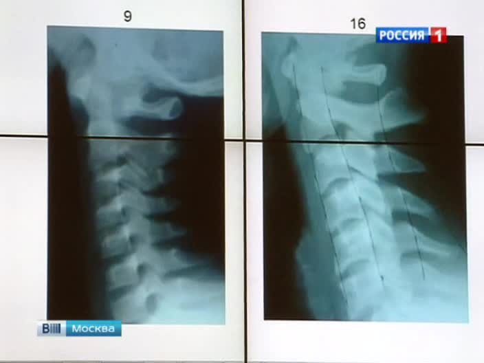 В Москве прошел международный телемост нейрохирургов