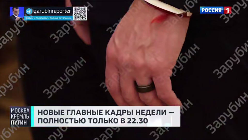 Кушнер и Грюнбаум на встрече в Кремле были в кольцах, измеряющих уровень стресса
