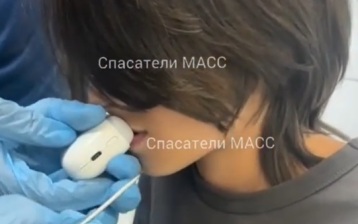 Машинка для ногтей закусила губу мальчика в Новосибирске, ее снимали спасатели