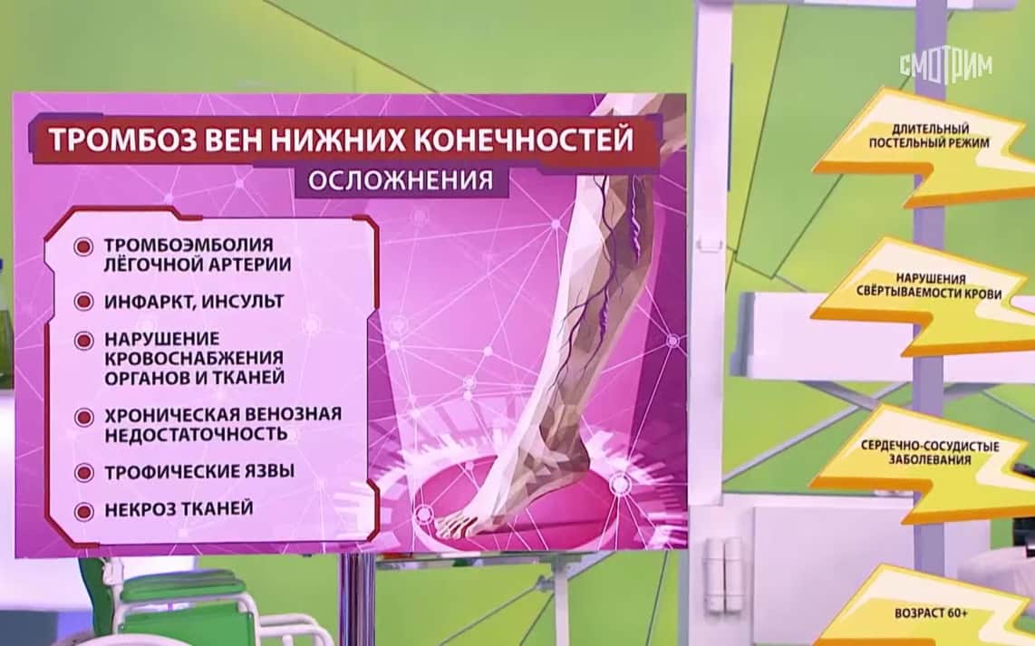 Врач назвала 10 факторов, способствующих тромбозу