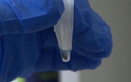 SHOT: жительница Оренбургской области обнаружила клеща между ресницами