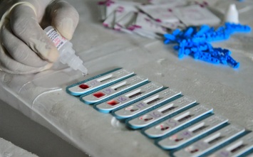 В Центре Гамалеи рассказали о разработке вакцины от ВИЧ