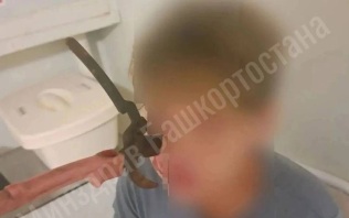 Садовый секатор вонзился в лицо подростку в Башкирии