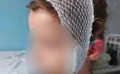 В Магнитогорске бродячая собака едва не оторвала ухо 6-летней девочке