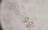 В Азовском и Черном морях обнаружен новый вид диатомовых водорослей